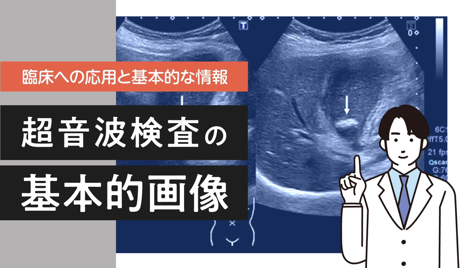 【臨床への応用と基本的な情報】超音波検査の基本的画像