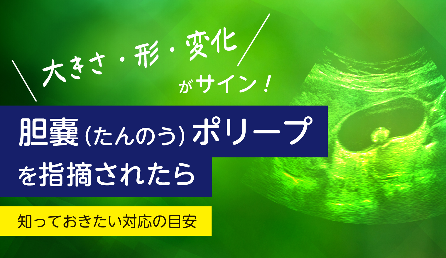 胆嚢（たんのう）ポリープを指摘されたら：知っておきたい対応の目安