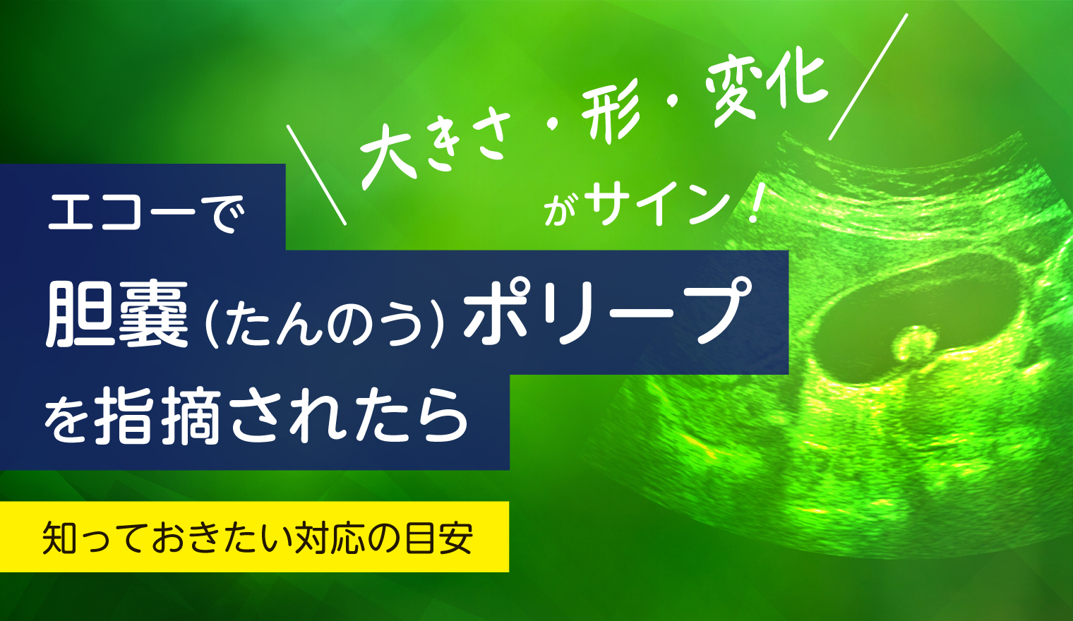 胆嚢（たんのう）ポリープを指摘されたら：知っておきたい対応の目安