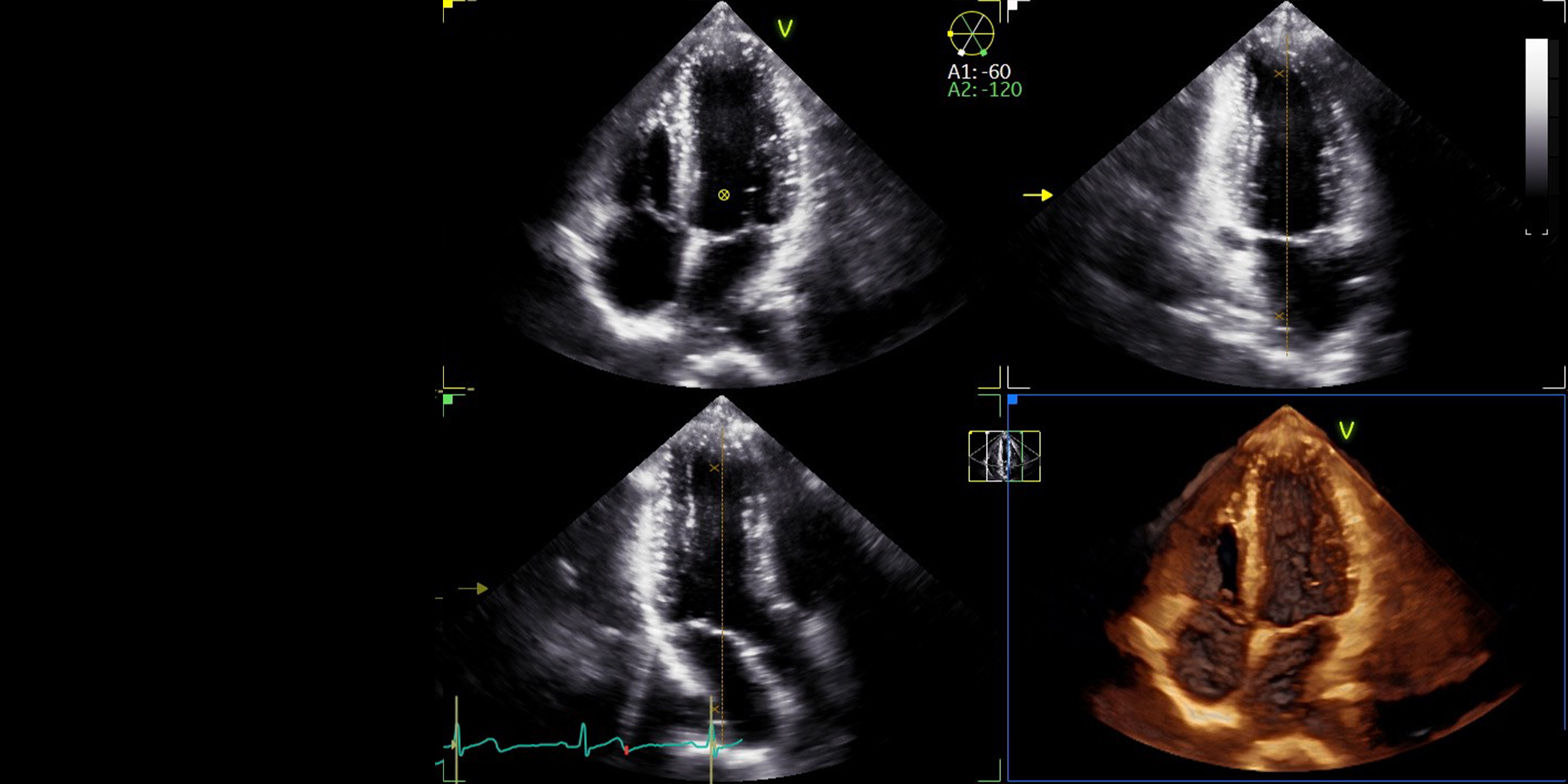 超音波が切り拓く新たな診断の世界