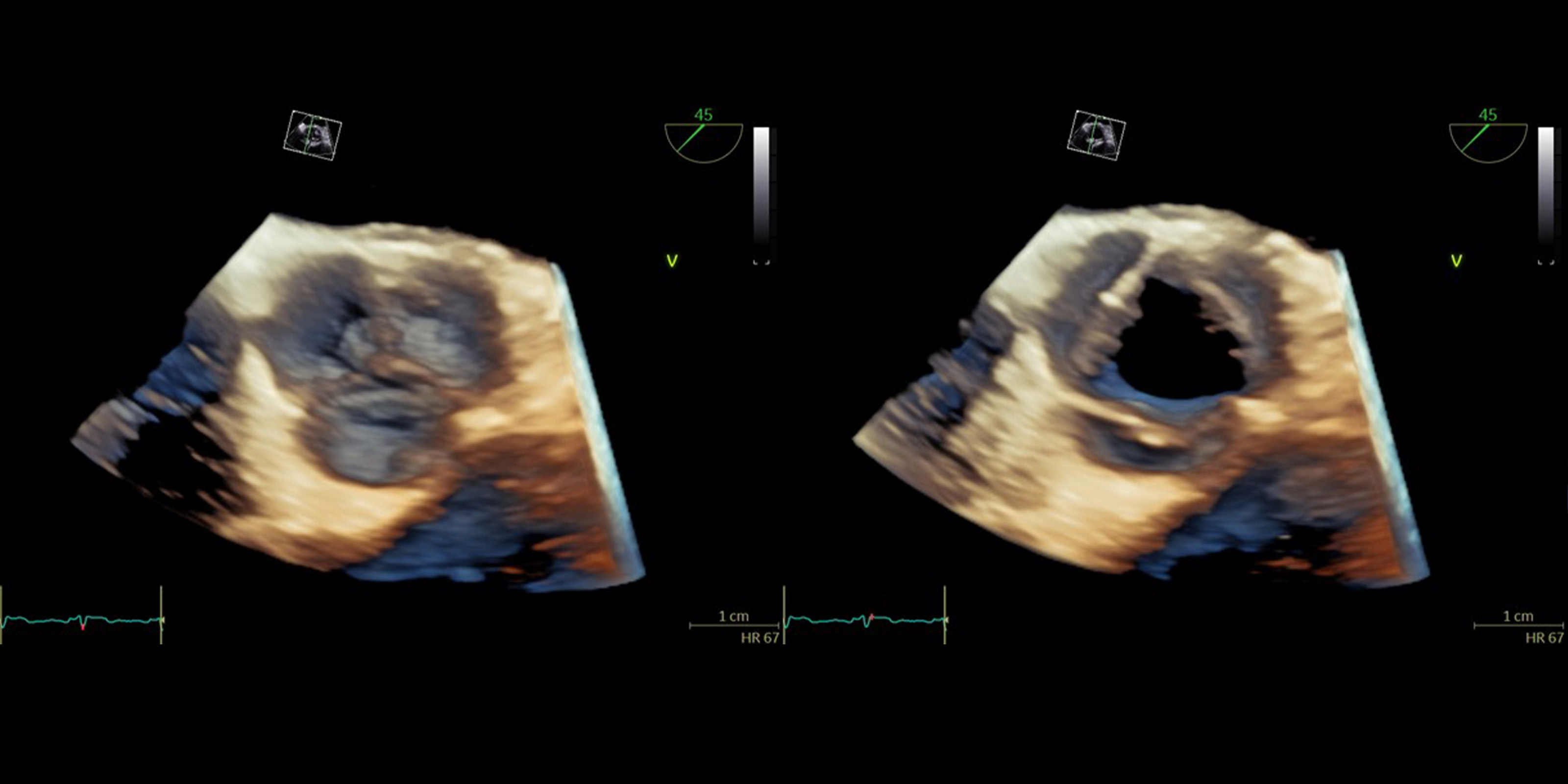超音波が切り拓く新たな診断の世界