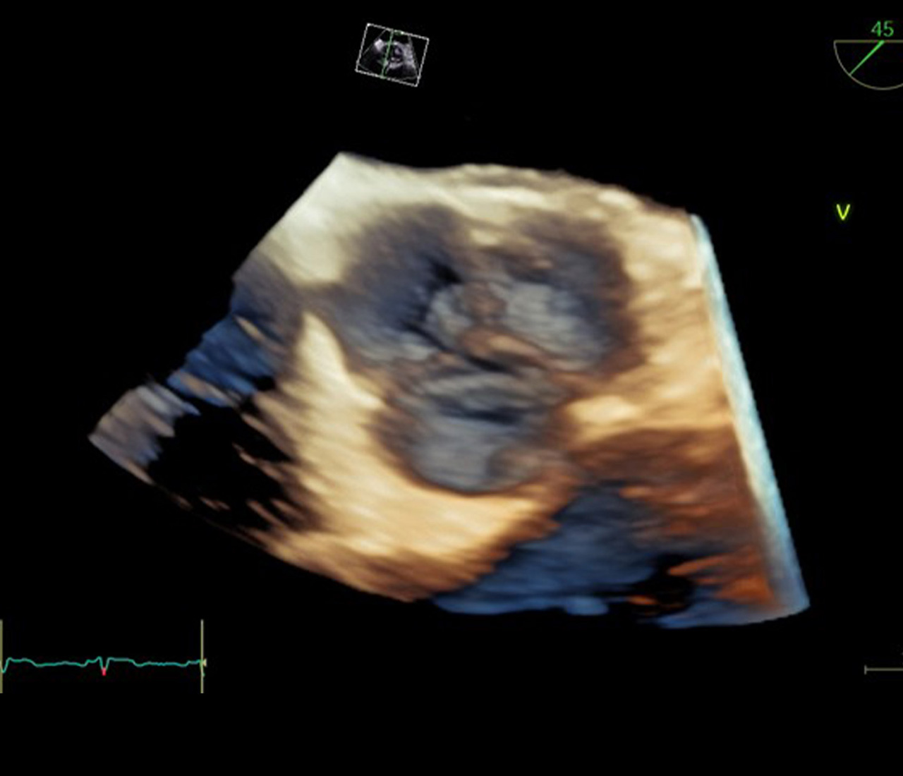 超音波が切り拓く新たな診断の世界